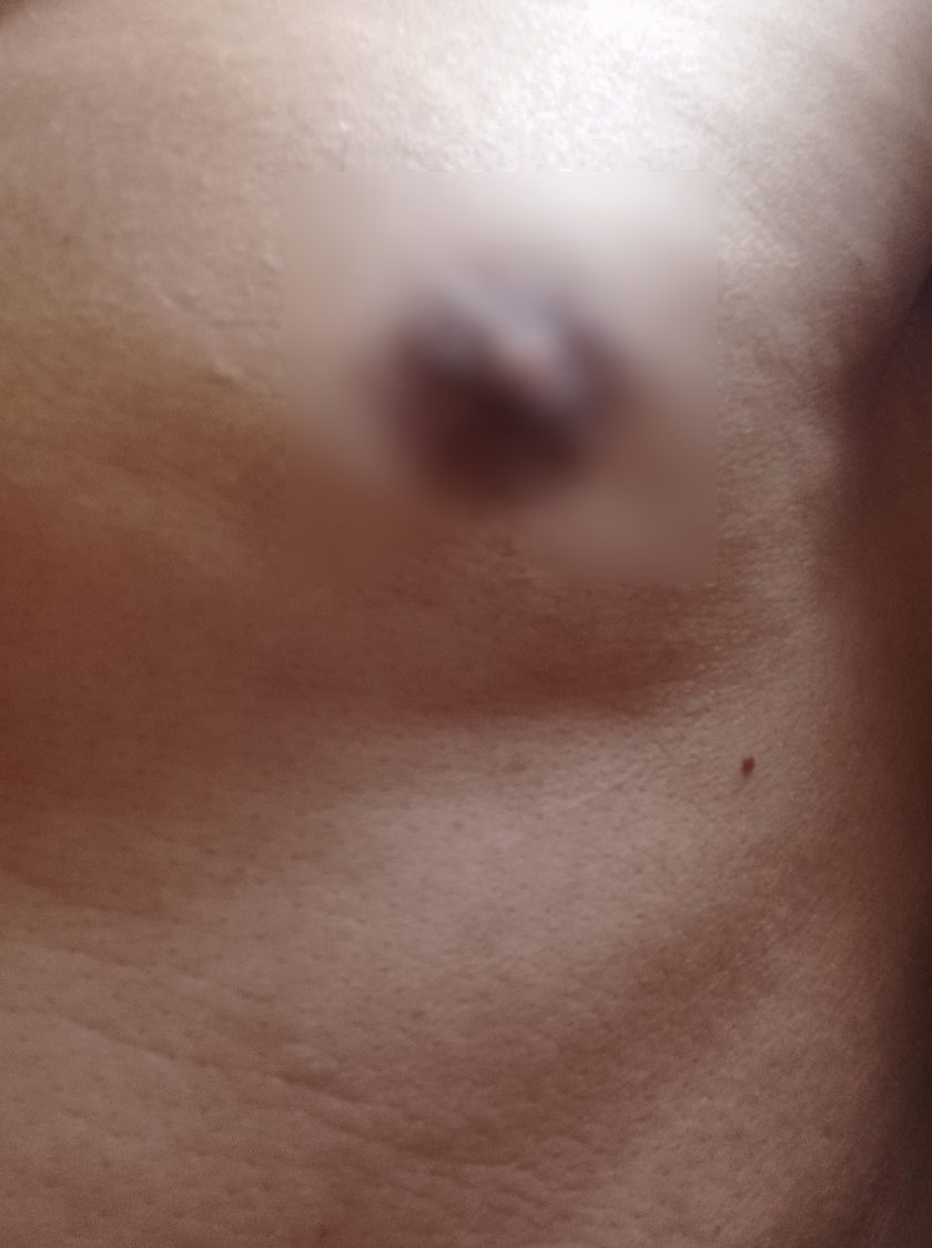 Asistente sexual para mujer