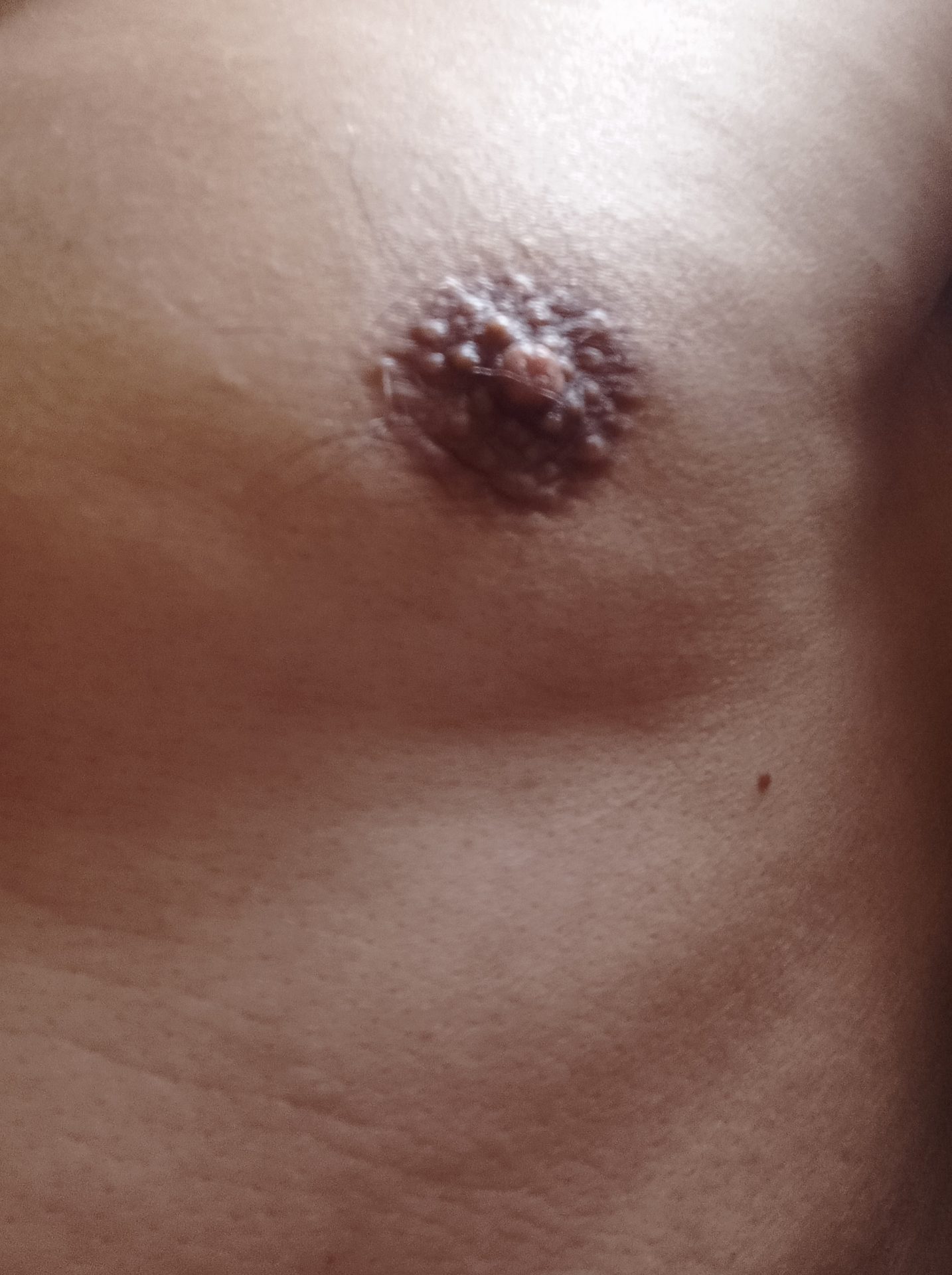 Asistente sexual para mujer